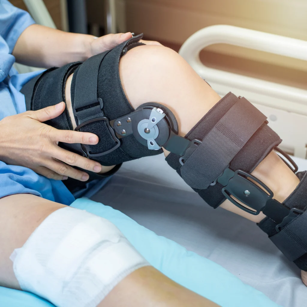 Post-Operative Rehabilitation